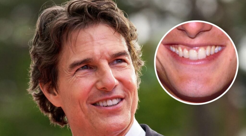 When Did Tom Cruise Finally Fix His Teeth