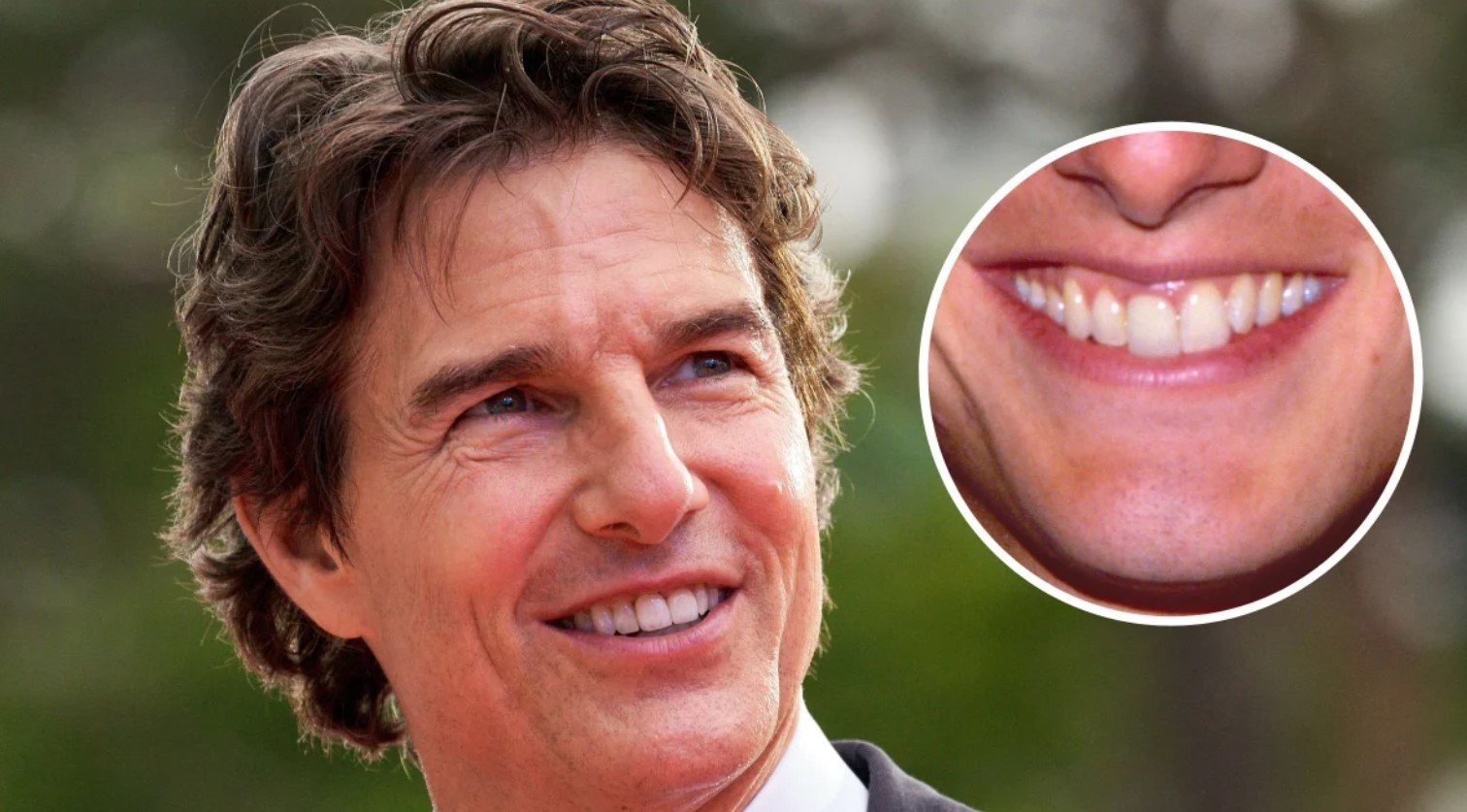 tom cruise early years teeth