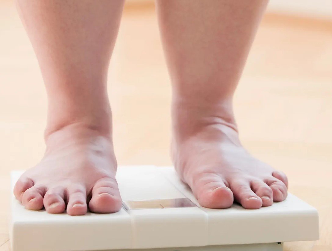 How weight loss can reverse prediabetes: new study