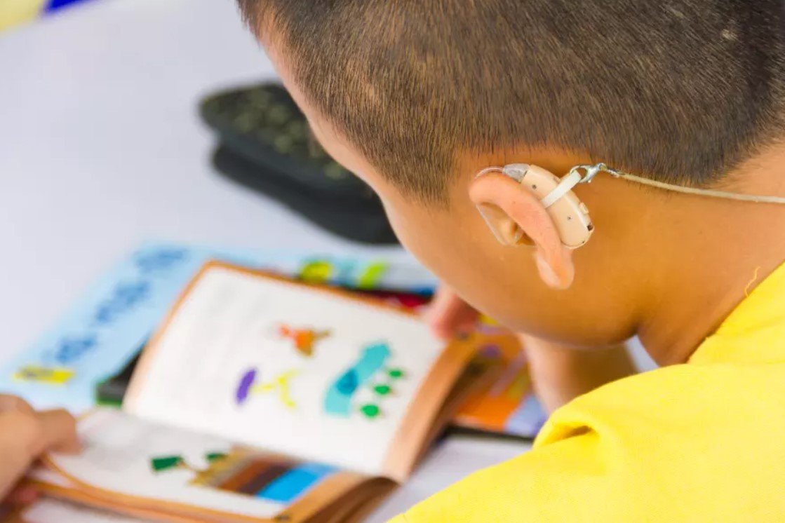 The Benefits of Hearing Aids and Cochlear Implants